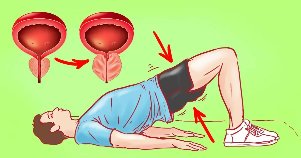 Vadba za prostatitis