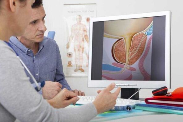zdravnik se posvetuje s pacientom glede vprašanja prostatitisa