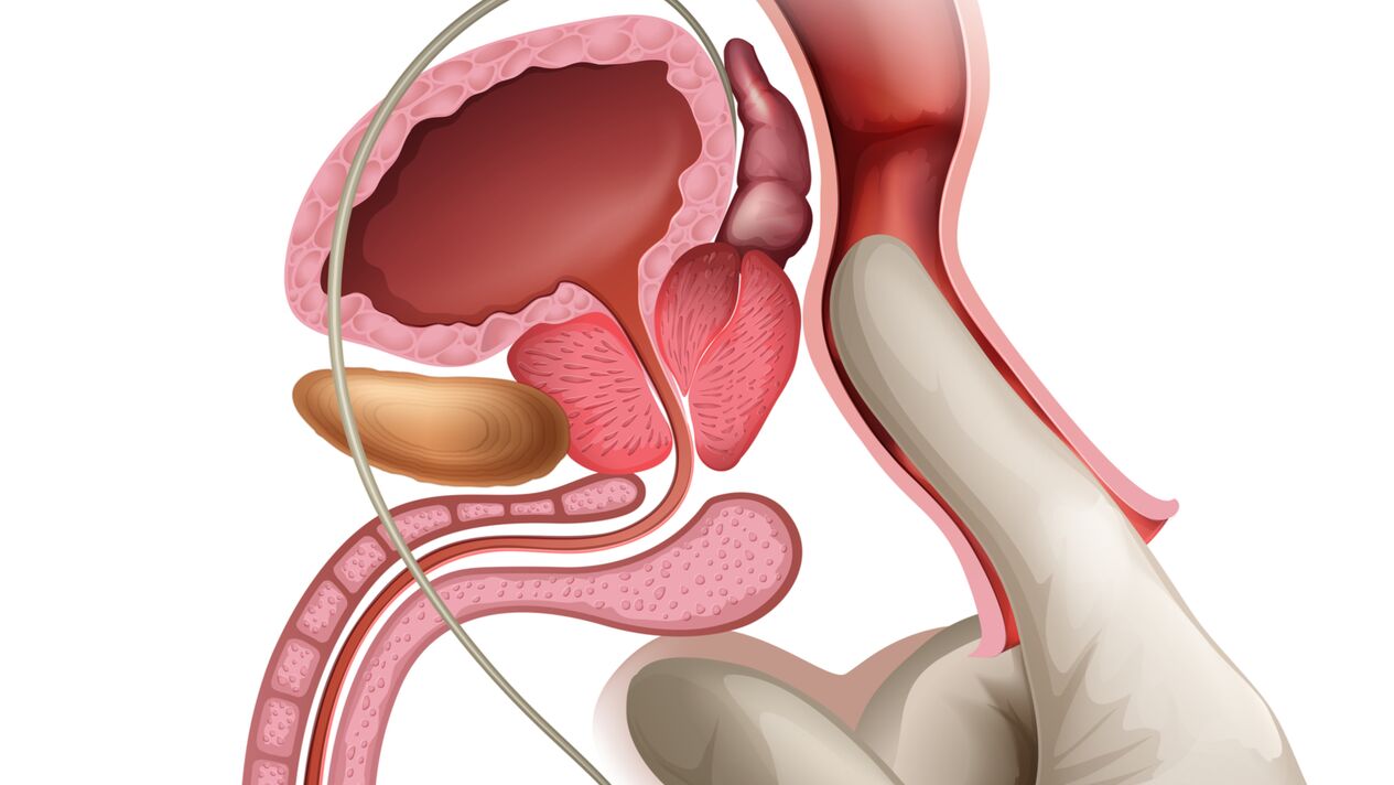 Masaža prostate je učinkovit način za zdravljenje kongestivnega prostatitisa